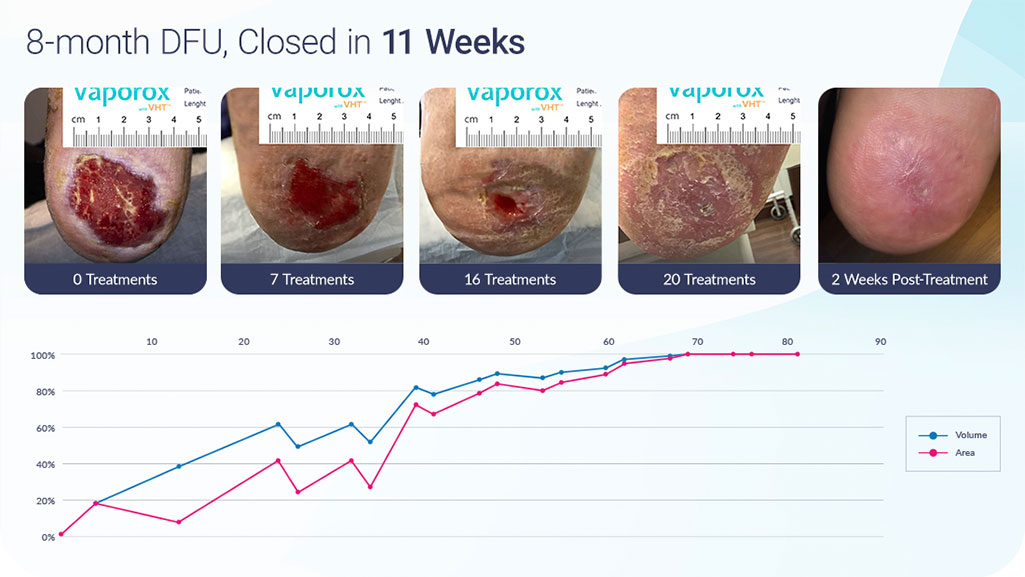 Vaporox 11 Weeks