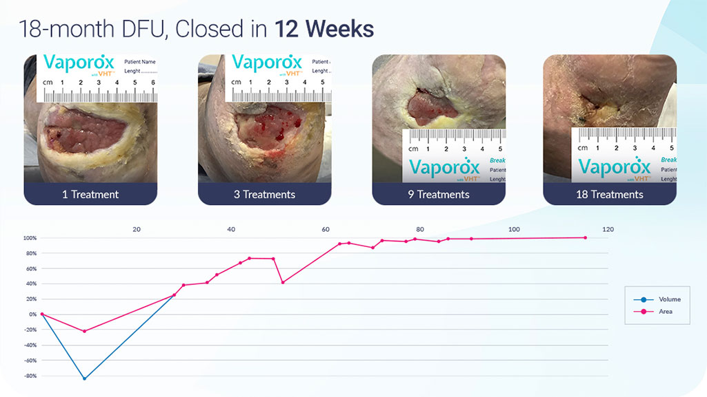 Vaporox 12 Weeks